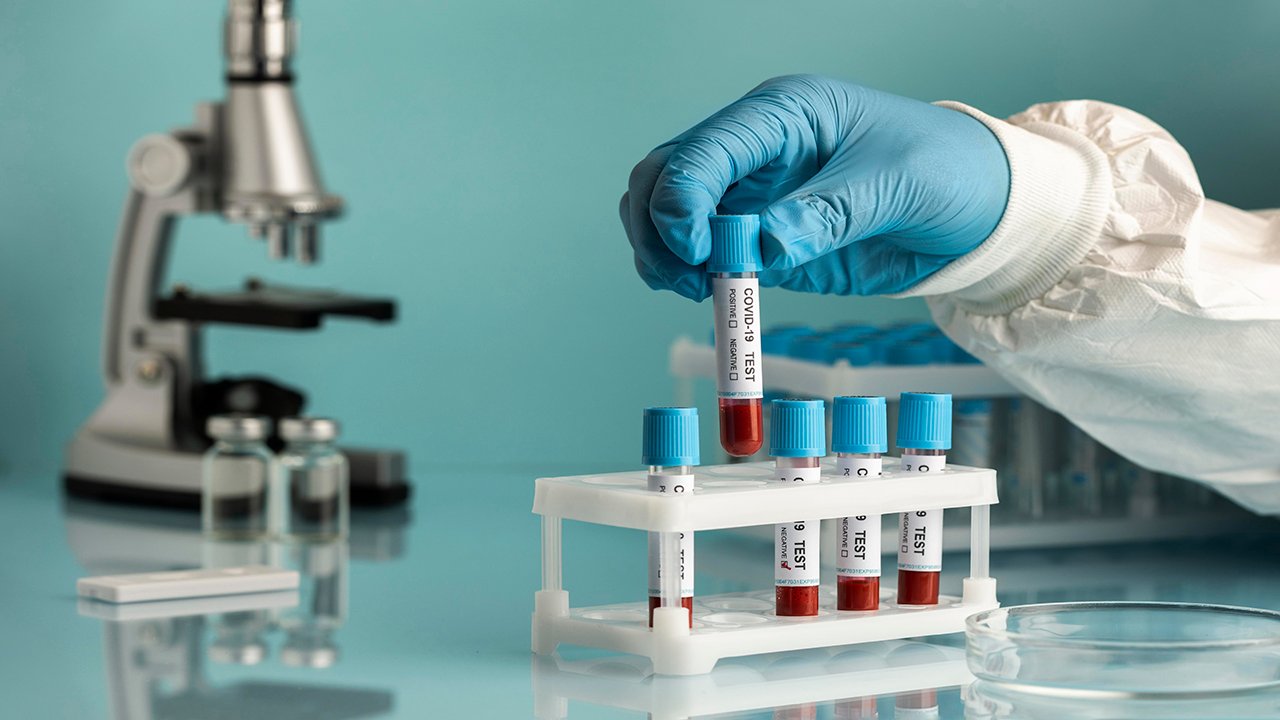 sswch Laboratory blood test